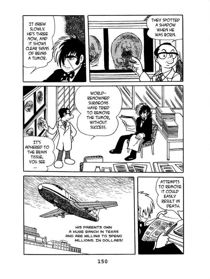 Black Jack Vol.6 Chapter 7: Brachydactyly - Picture 2